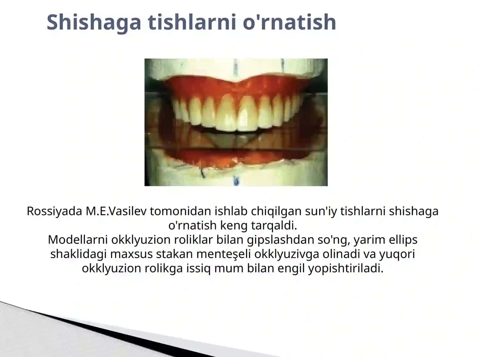 Sun'iy tishlarni tanlash. Sun'iy tishlarni okklyudator va artikulyatorda shisha ustiga qo'yish usuli . Ortognatik jag' munosabatlarida sun'iy tishlarni joylashtirish . 3