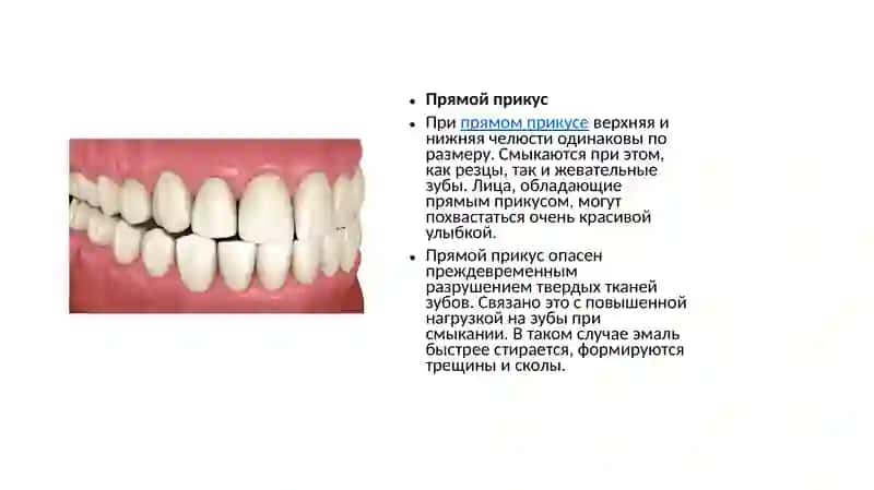 Ортогнатический прикус 3