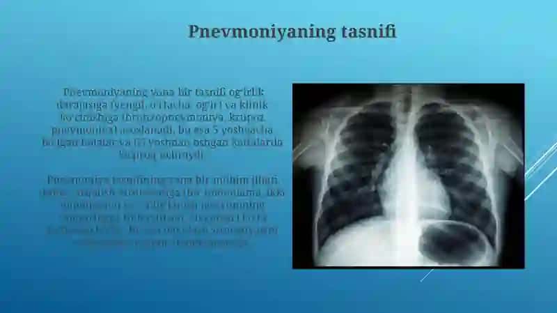 Pnevmoniya etiologiyasi, klassifikatsiyasi 3