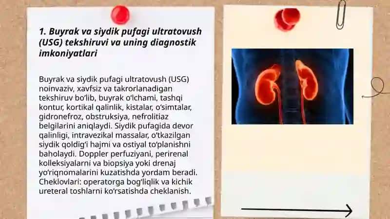 Siydik ayiruv tizimi kasalliklari nur tashxisoti 438 gurux talabasi Mirsharifova Shaxzoda 3