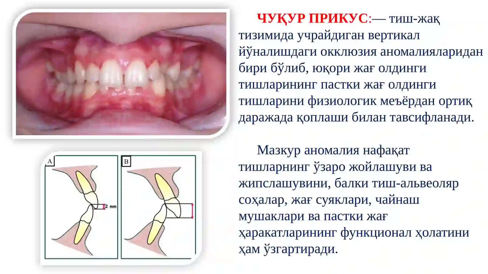 ЧУҚУР ПРИКУС. ЭТИОЛОГИЯСИ, ПАТОГEНEЗИ ВА КЛИНИКАСИ, ТАШХИСЛАШ ВА ДАВОЛАШ 3