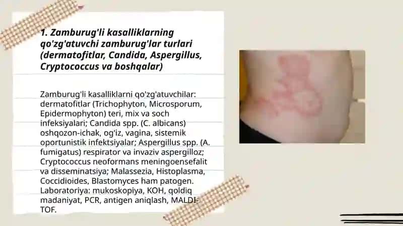 Zamburug'li kasalliklarning qo'zg'atuvchilari.Pataginezi. Labarato'r tekshiruvi 3