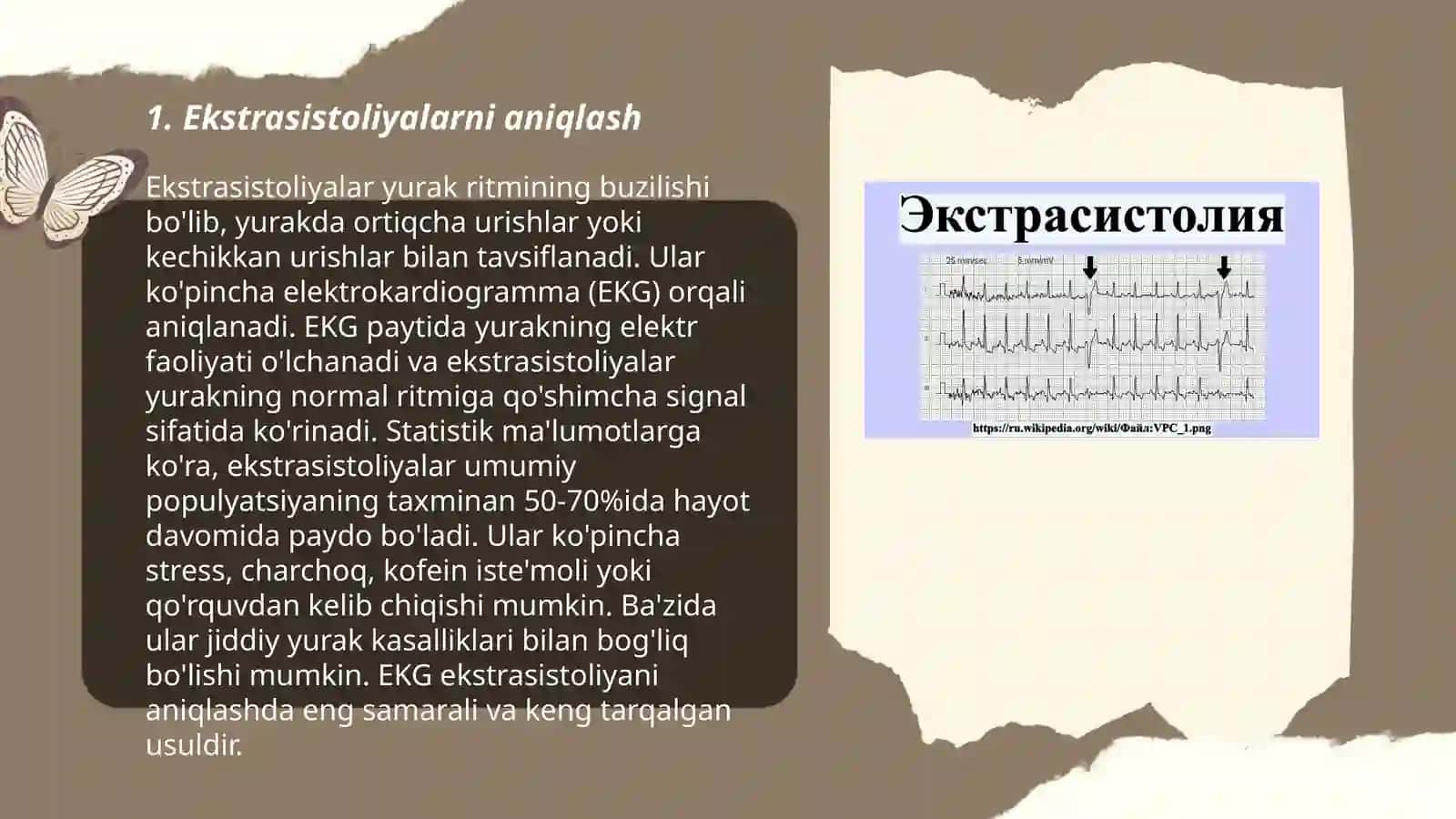 Ekstrasistoliyalar 3