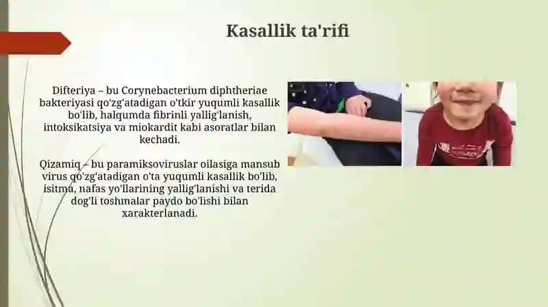 Difteriya, qizamiq va skarlatina 3