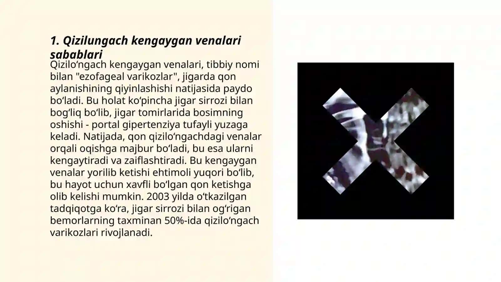 Qizilungach kengaygan venalaridan qon ketish va to’xtatish belgilari 3