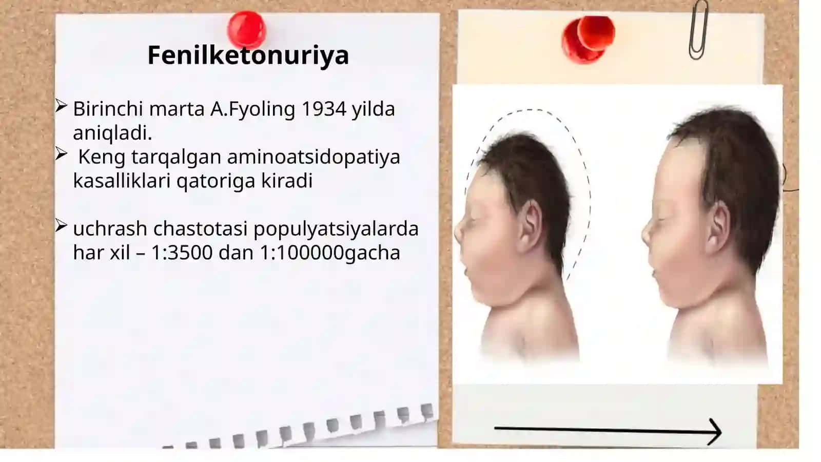 Odamda gen tuzilishi va funksiyalari. Monogen kasalliklar. Aminokislotalar almashinuvining buzilishi 3