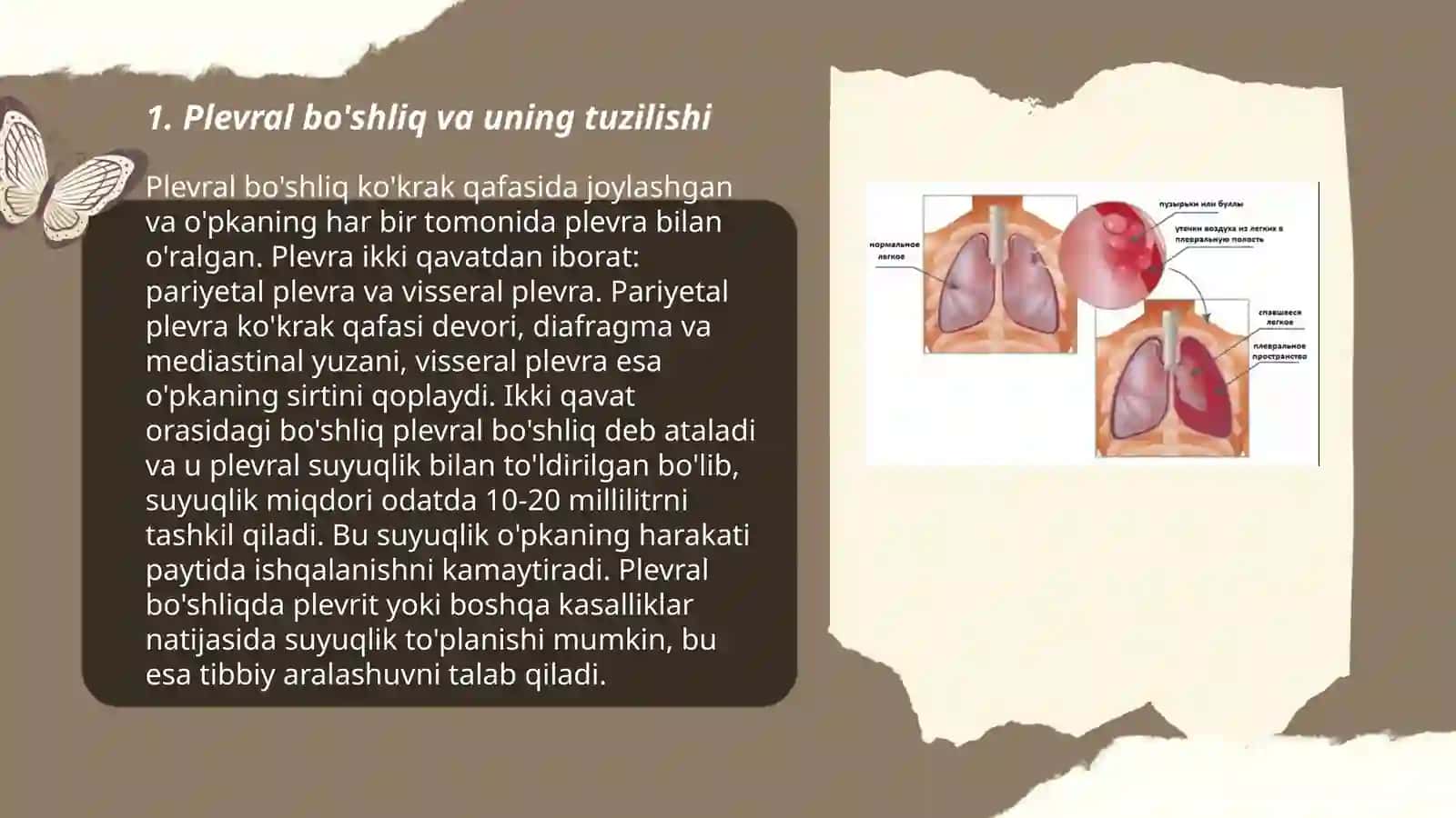 Pnevmotoraks kasalligi 3