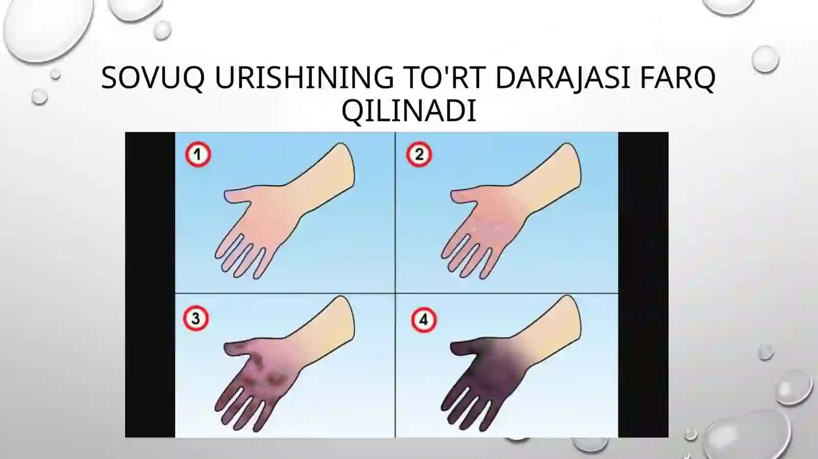 Sovuq urishi 3