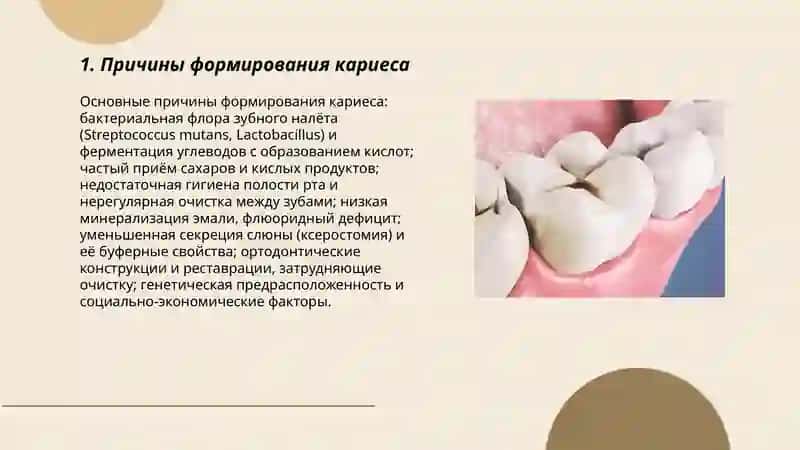 Кариес 3