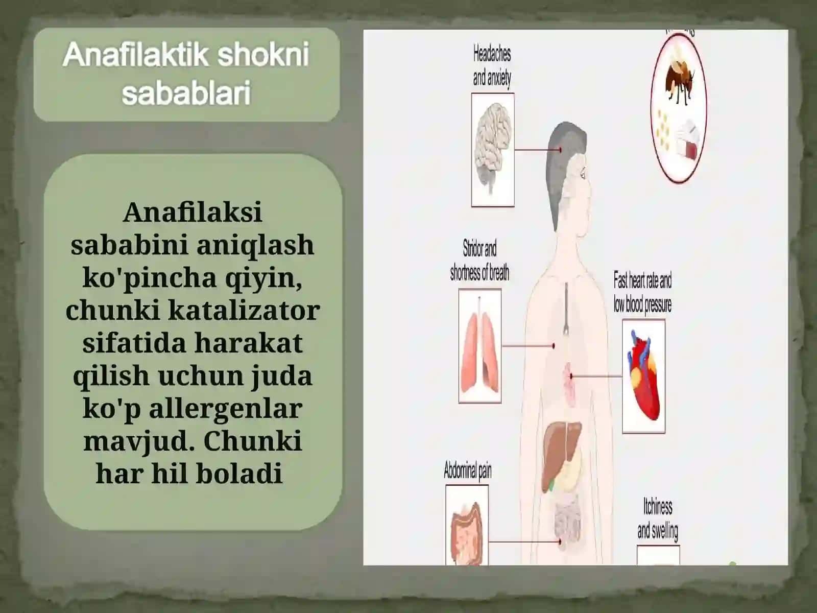 Anafilaktik shok 3