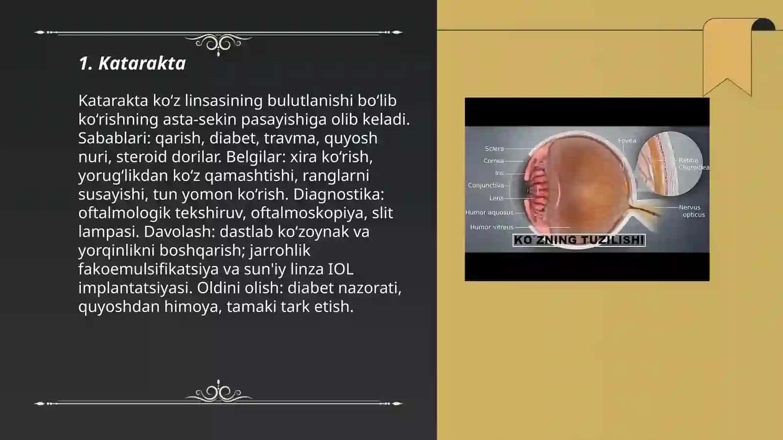 Koʻz kasalliklari 3