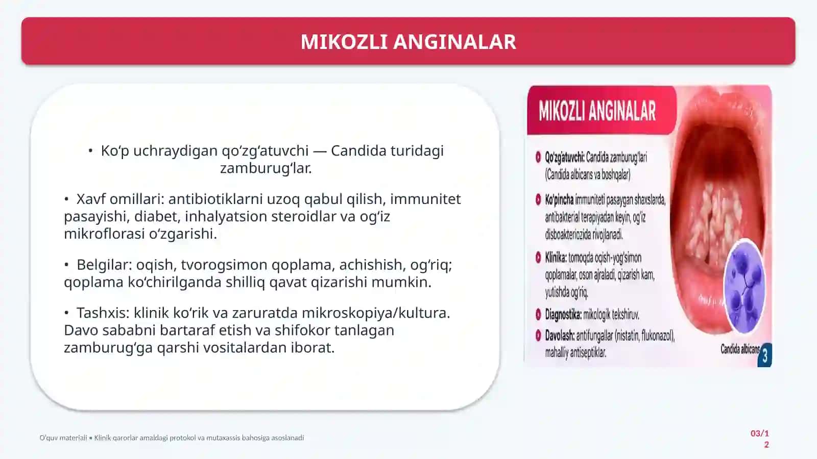 HAR XIL ETIOLOGIYALIANGINALAR VA BOSHQAKASALLIKLAR 3