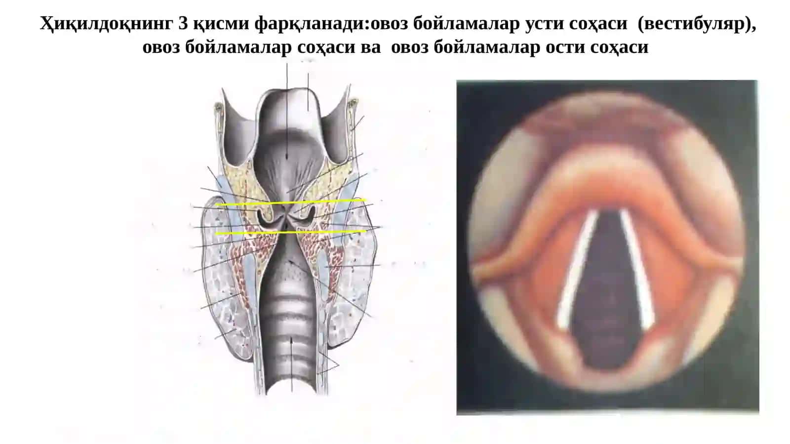 Ҳиқилдоқраки 3