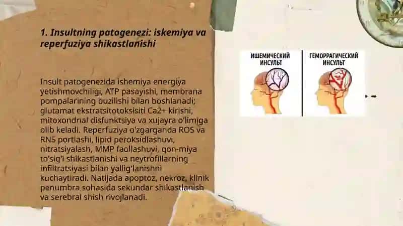 Insult patogenezi klinikasi epidimiologiyasi ishemik va gemoragik turi diagnostikasi davolash 3