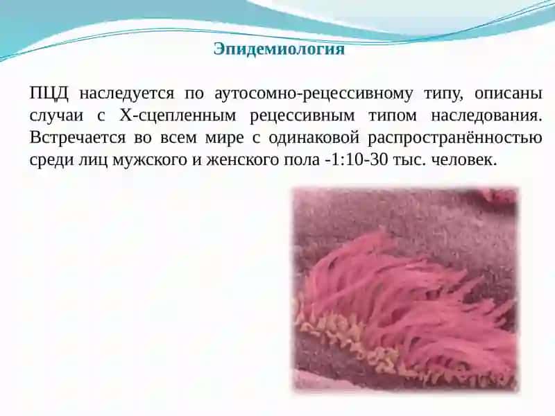 Синдром Картагенера 3