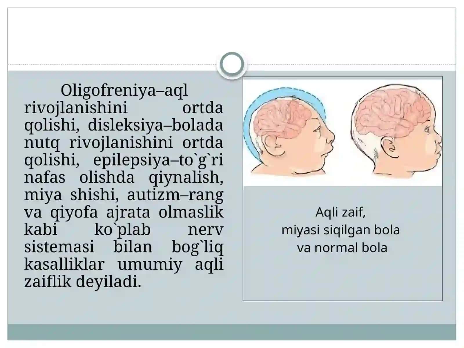 Oligofreniya, disleksiya, epilepsiya va autizm 3