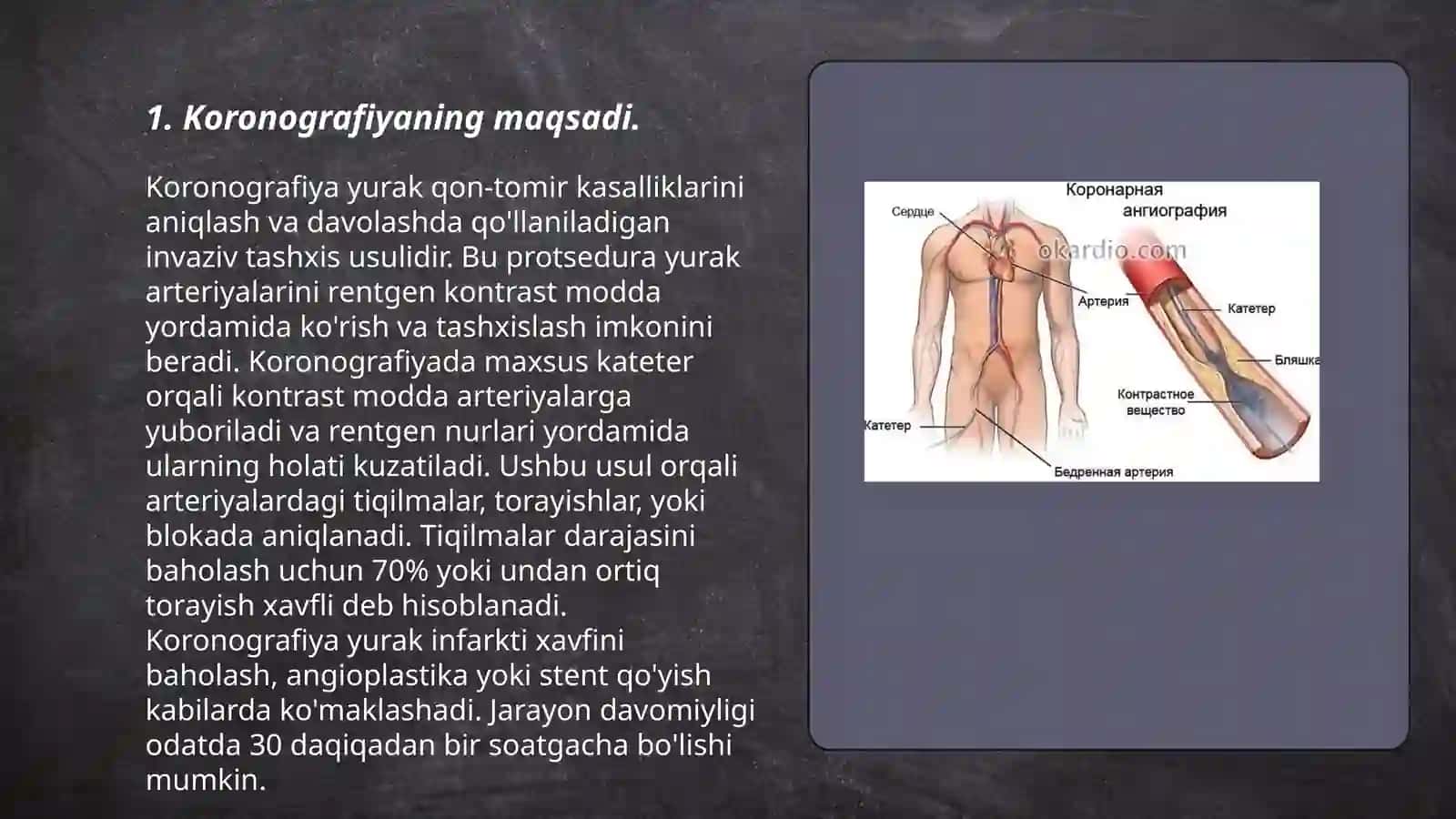 Koronografiya. Ko'rsatma va qarshi ko'rsatmalar 3