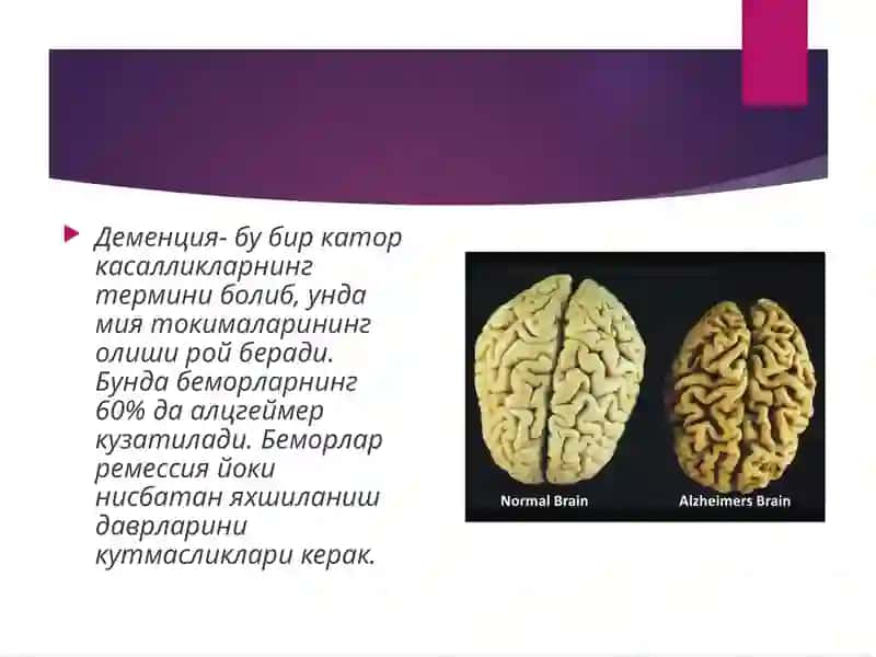 Сенил деменция 3