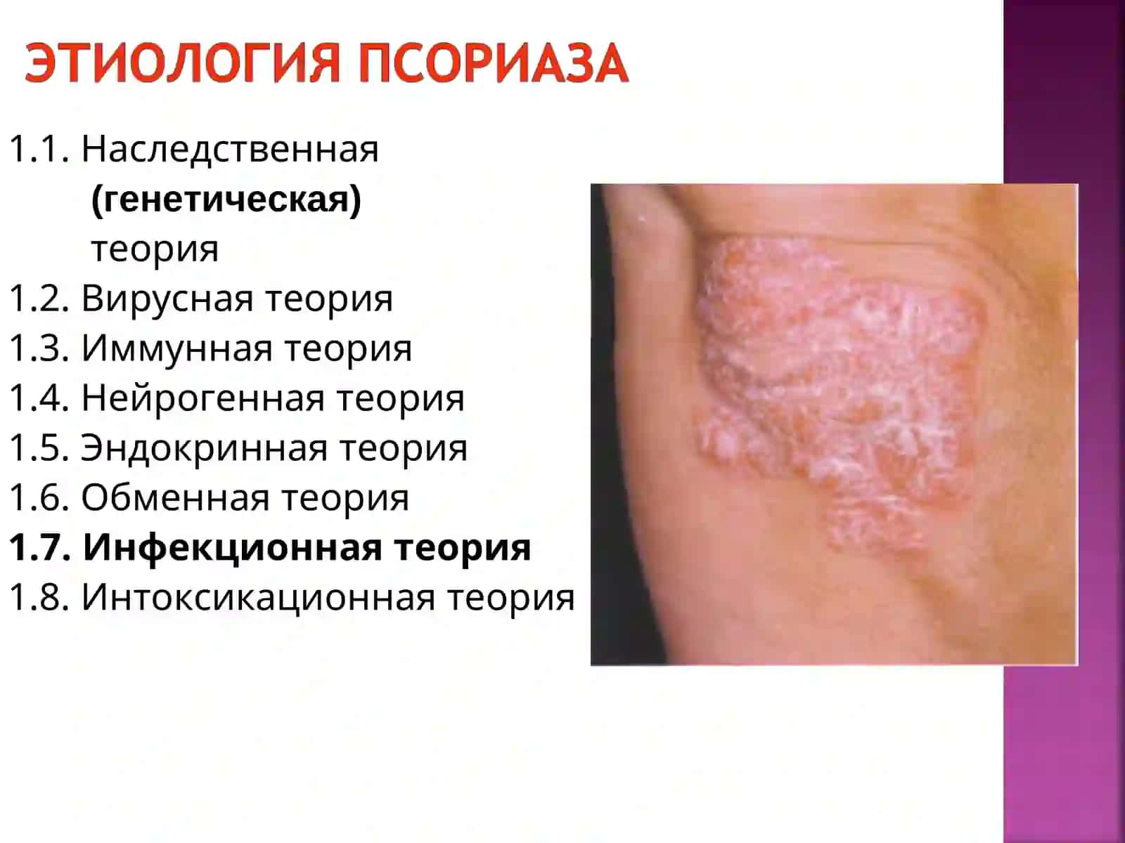 Псориаз 3