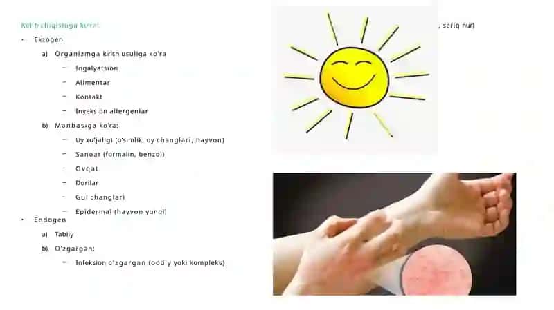 Allergiya 3