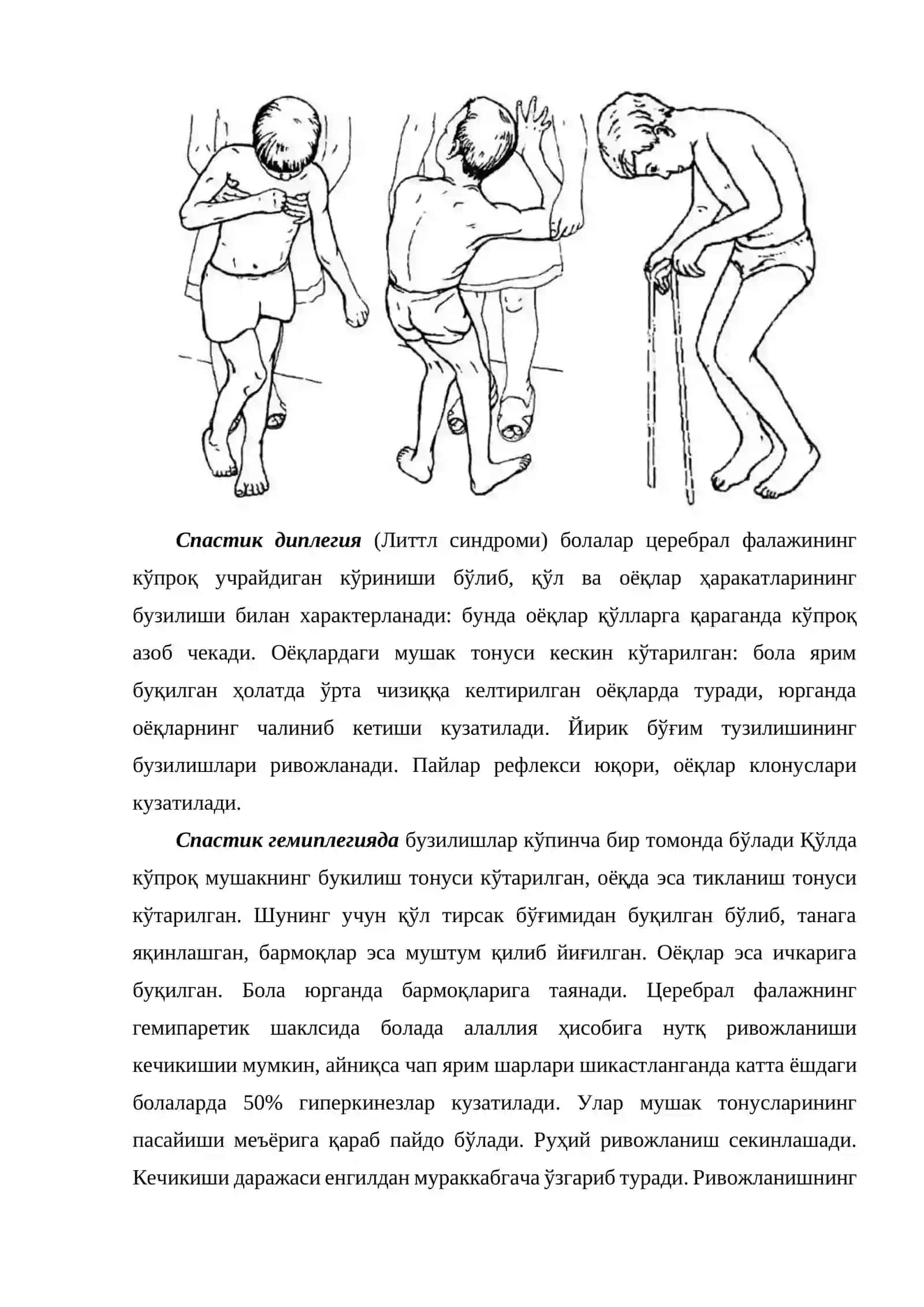 Марказий ва периферик фалажлар 3