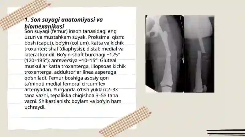 Son suyagi sinishi va chiqishi. Klinikasi, tashxisi va davolash 3