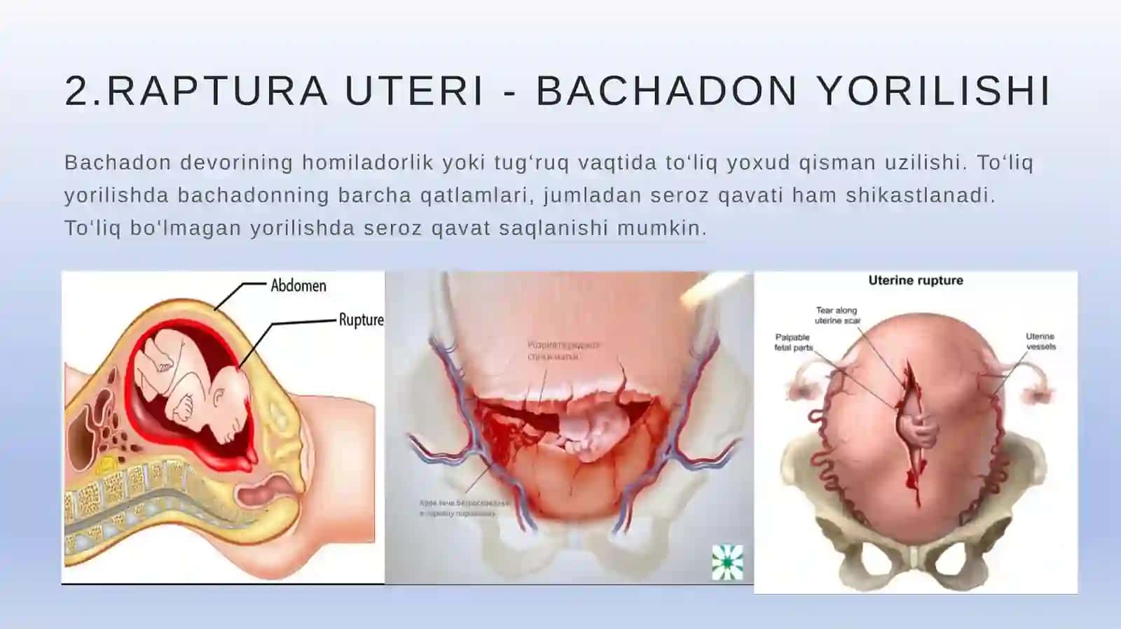 Akusherlik operatsiyalari va chaqaloq reanimatsiyasi 3