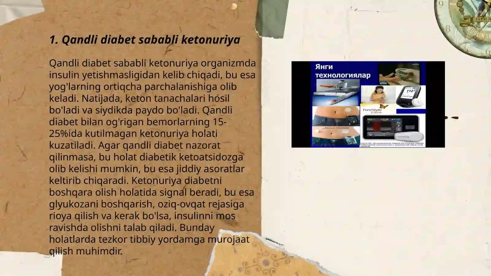 Qandli diabet va ochlikda ketonuriya va ketonimiya 3