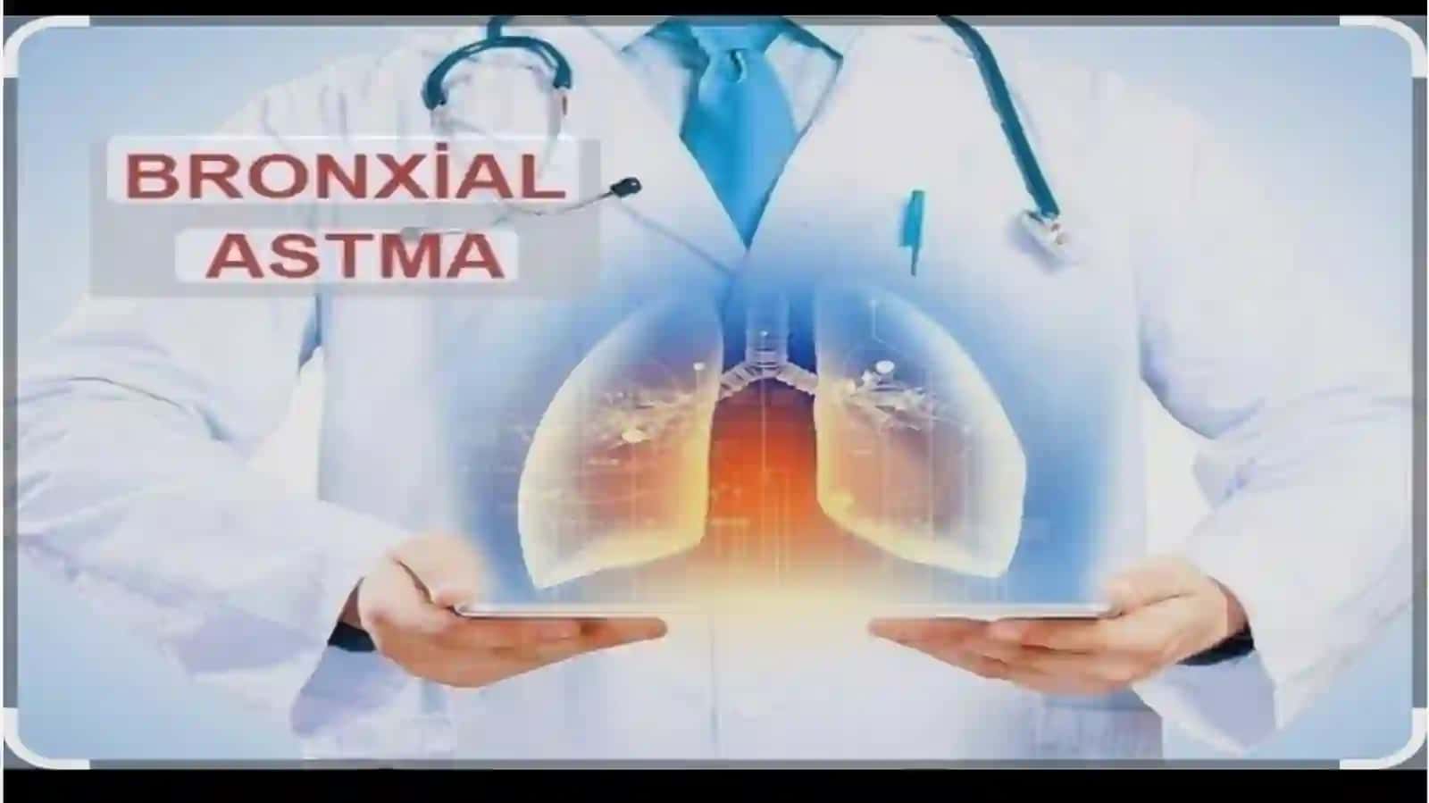 Bronxial astmaning farmakoterapiyasi 3