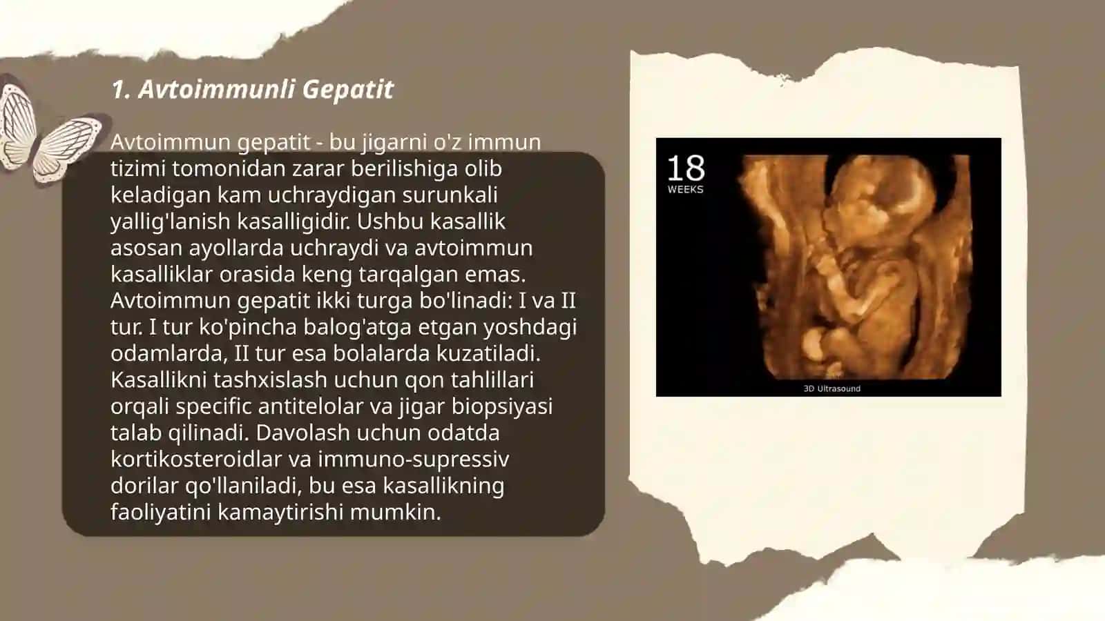 Avtoimmunli Gepatit 3