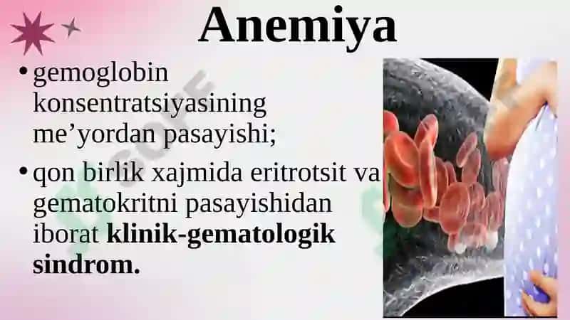 Анемия 3