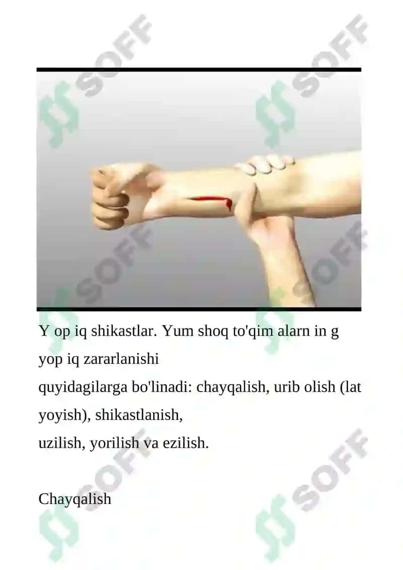 BOLALARDA YUMSHOQ TOQIMALARNI JAROXATLANISHI 3