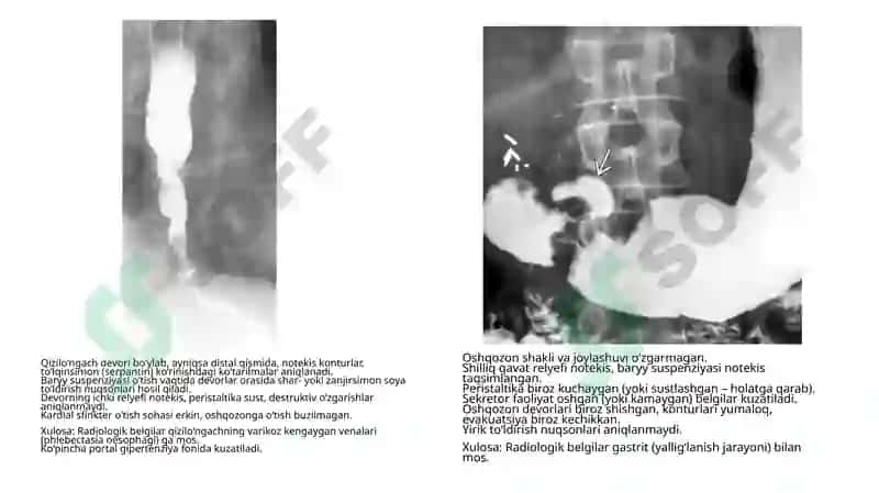 Rentgen tahlillari yig'indisi tibbiy radiologiya 3