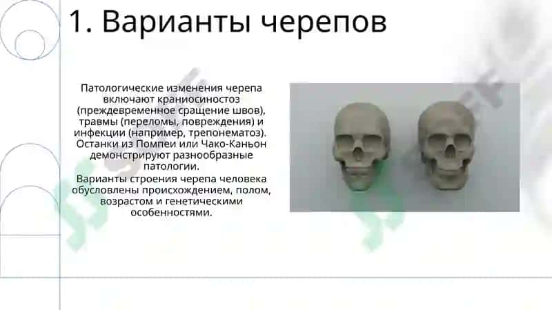 Череп 3