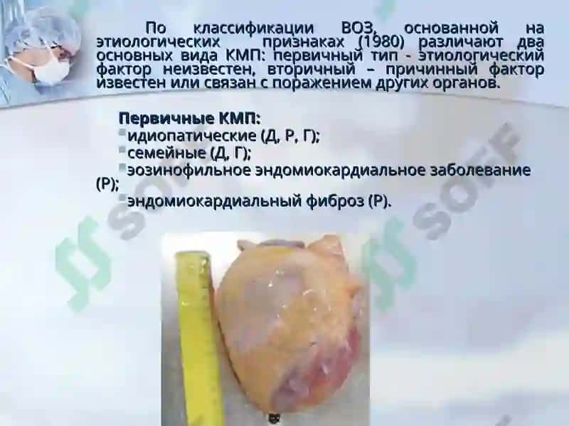 Кардиомиопатии 3