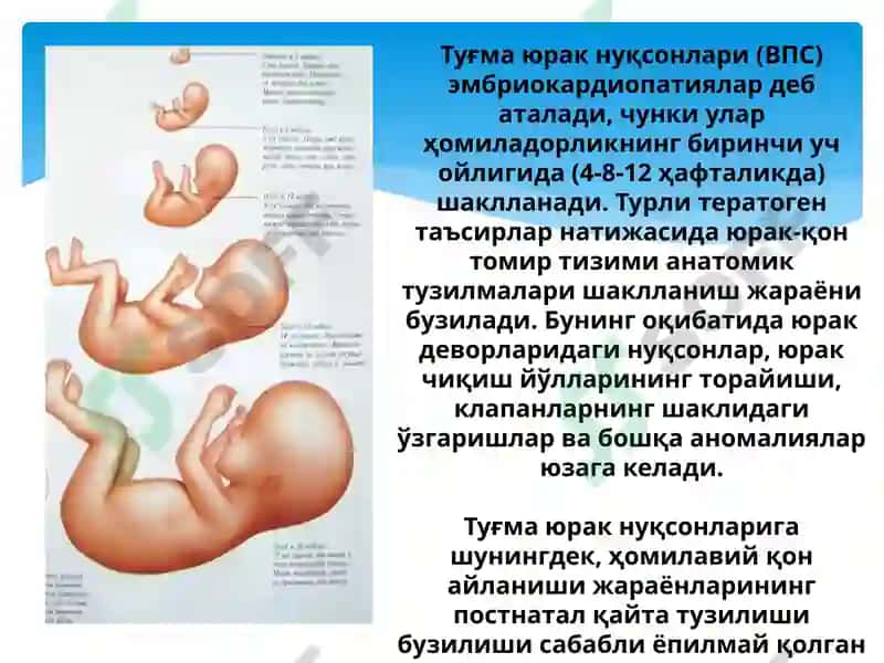 Туғма юрак нуксонлари 3