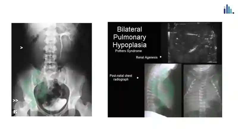 Renal Panalogiya 3