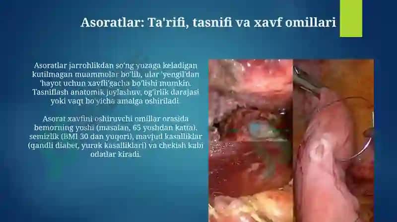Asoratlar va ularning profilaktikasi 3