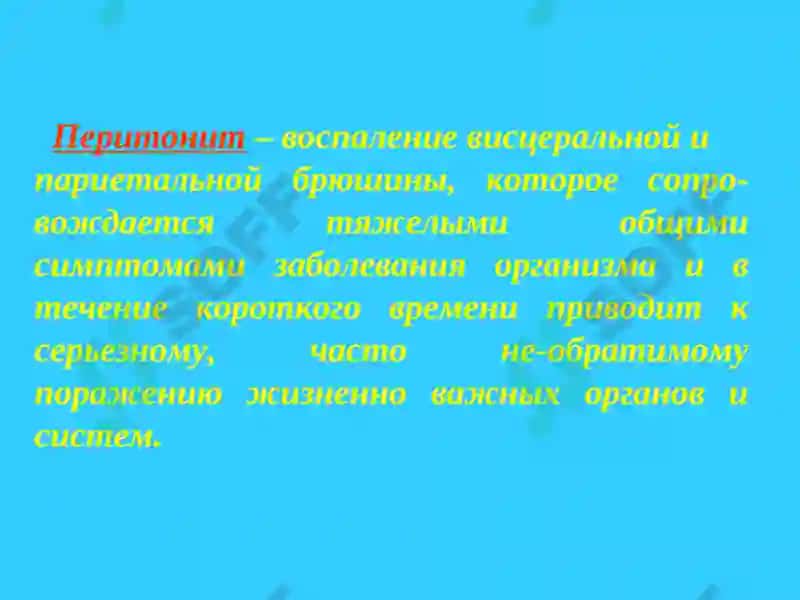 Перитонит 3