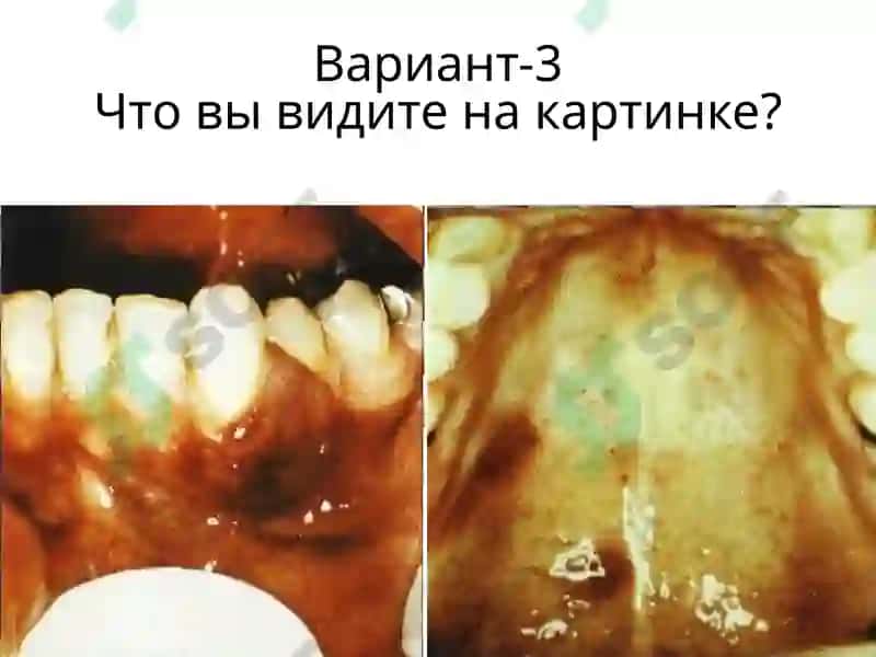 Вариант-1 3
