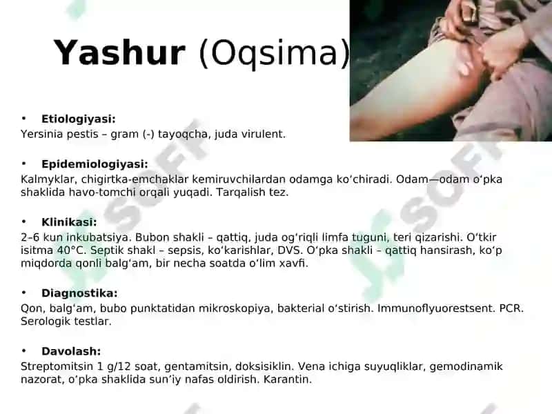 O‘ta hafli infeksiyalar 3