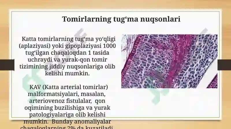 Vena va limfa tomirlari patologiyasi.Tomirlarga aralashishdagi patologiya(intervensii) 3