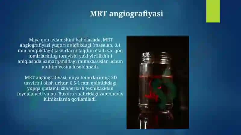MRT angiografiyasi 3