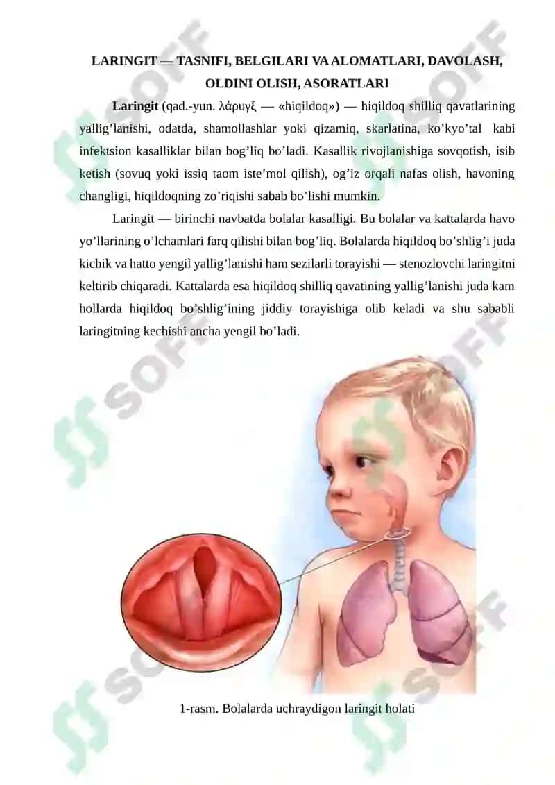 Laringit kasalligi haqida 3
