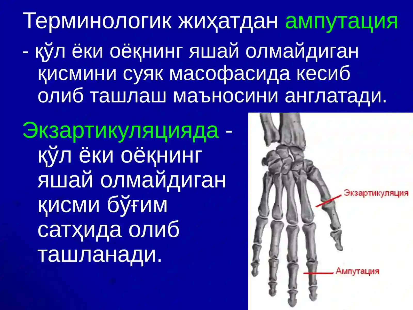Ампутация ва Экзартикуляциялар 3