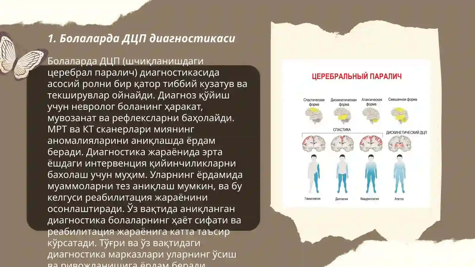 Болаларда ДЦП (шчиқланишдаги церебрал паралич) диагностикаси 3