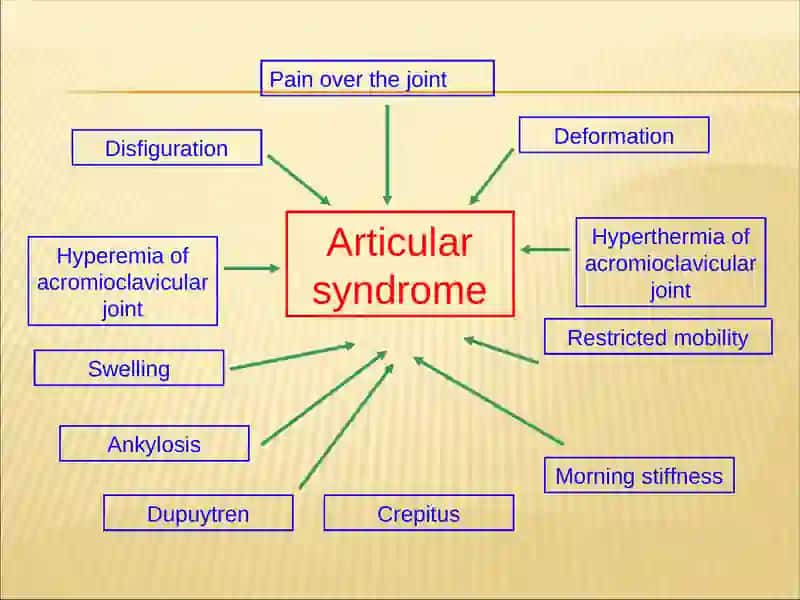 Articular syndrome 3