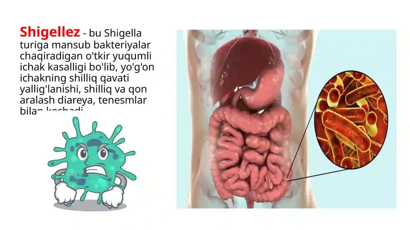 Shigellez amebiaz 3