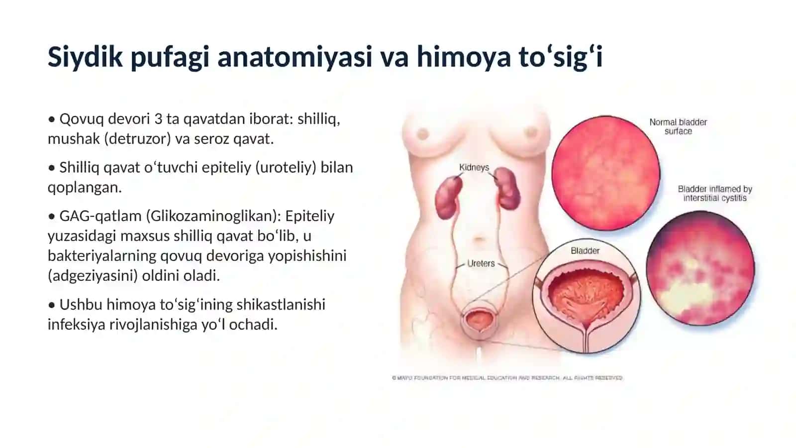 O‘TKIR SISTIT(Acute Cystitis) 3