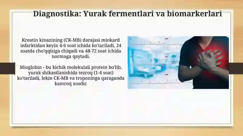 Miokard infarkti 3